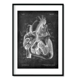 Anatomie cardiaque - Chalkboard - Lot de 3