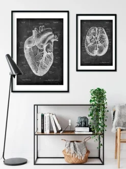 Anatomie cardiaque I - Chalkboard