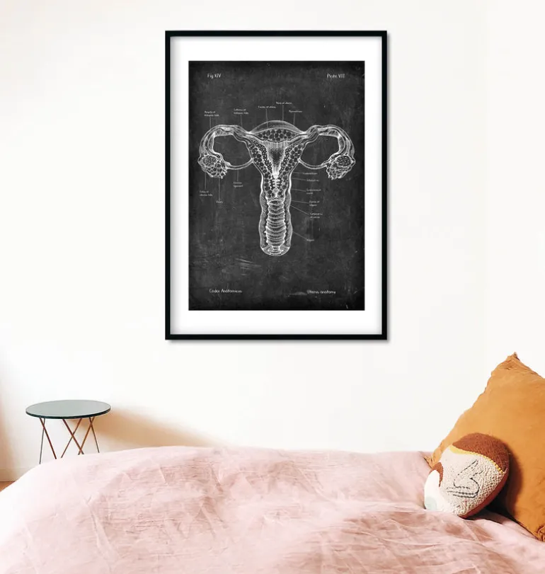 Anatomie de l'utérus - Chalkboard
