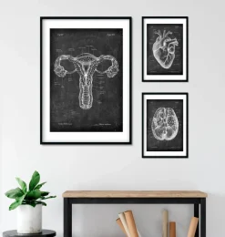 Anatomie de l'utérus - Chalkboard