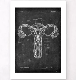 Anatomie de l'utérus - Chalkboard
