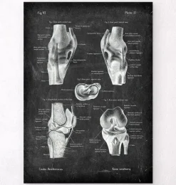 Anatomie du genou II - Chalkboard