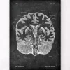 Cerveau disséqué - Chalkboard