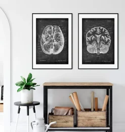 Cerveau disséqué - Chalkboard
