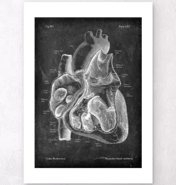 Dissected heart anatomy II - Chalkboard