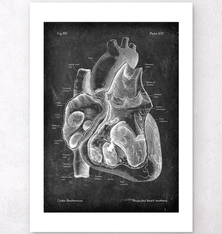 Dissected heart anatomy II - Chalkboard