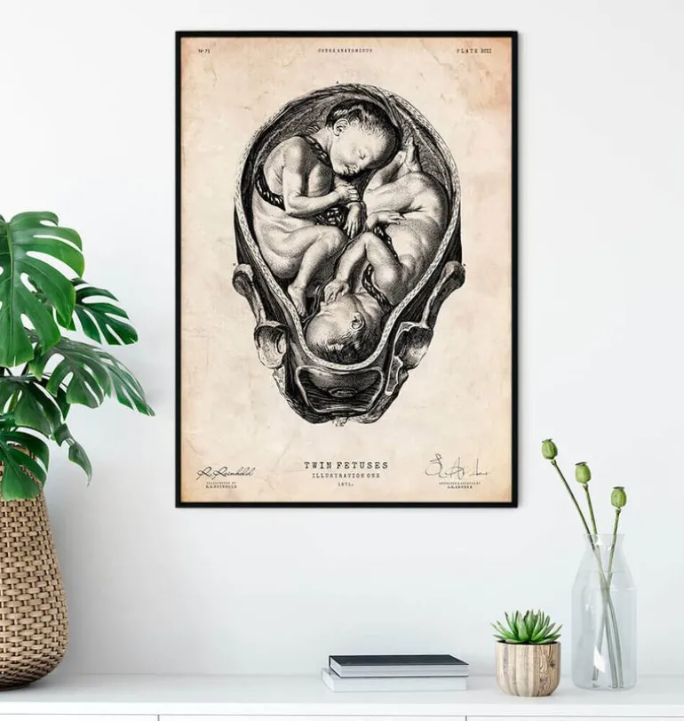 Foetus II
