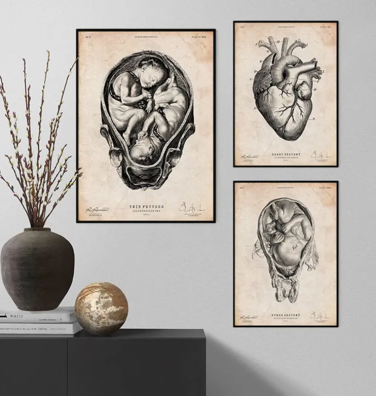 Foetus II