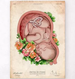 Foetus in a utérus II - Vieux papier