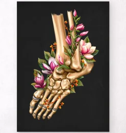 Fracture de la cheville - Floral - Noir