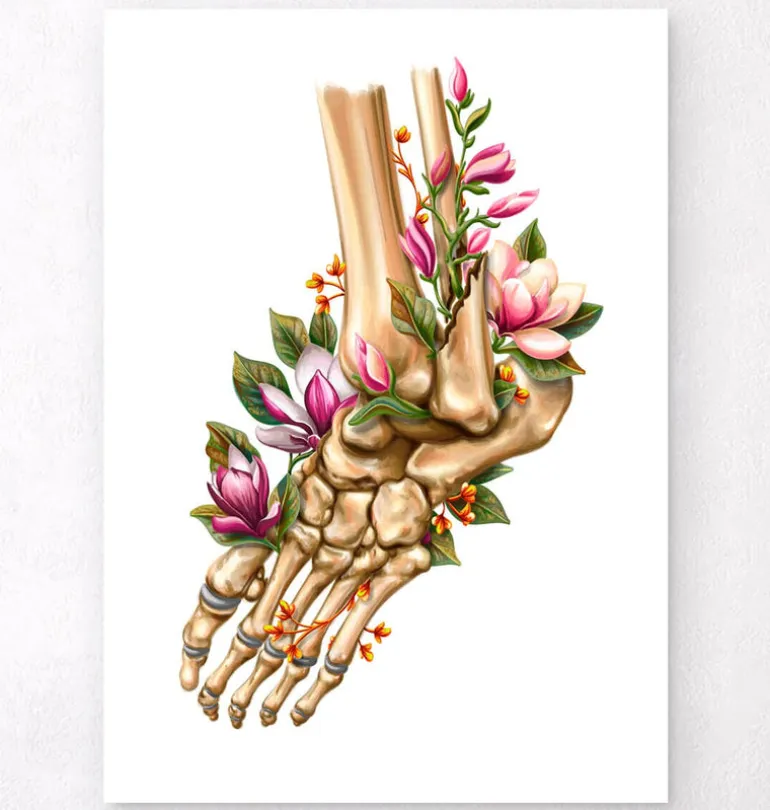 Fracture de la cheville - Floral - Blanc