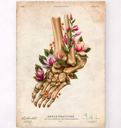 Fracture de la cheville - Floral - Vintage