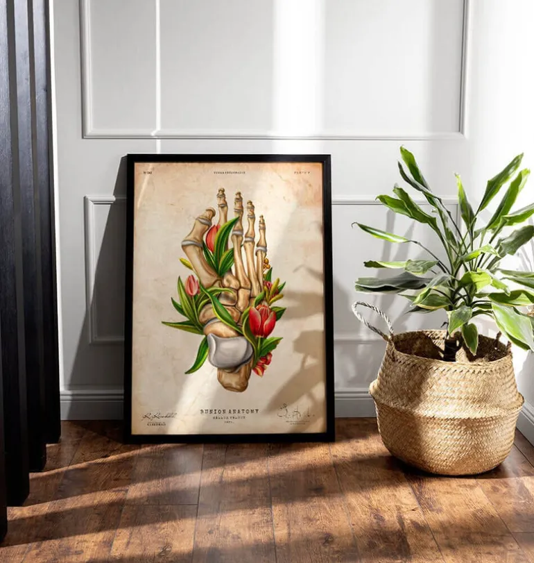 Hallux valgus - Floral - Vintage