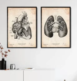 Impression d'anatomie pulmonaire II