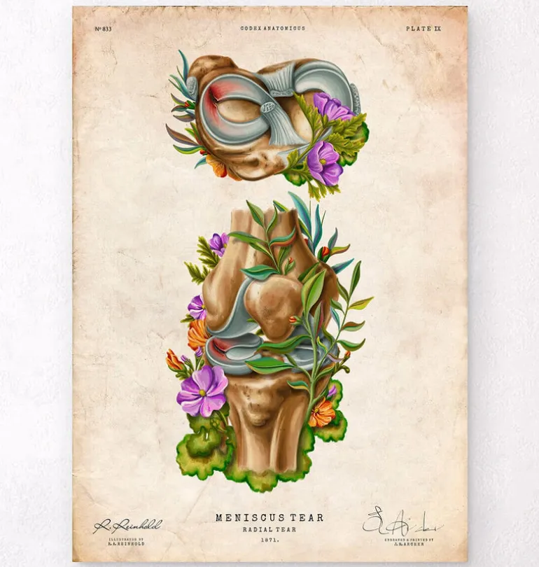 Lésion méniscale - Floral - Vintage