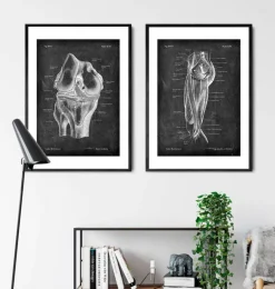 Muscles des jambes - Chalkboard