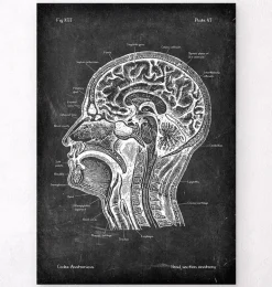 Section de la tête - Chalkboard