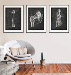 Tibia et fibula - Chalkboard