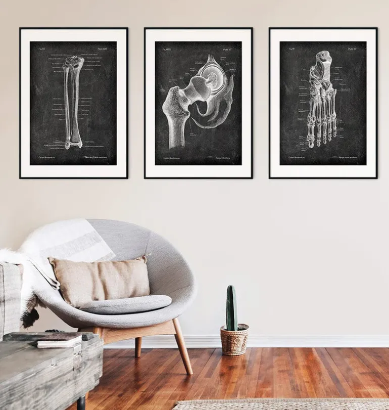 Tibia et fibula - Chalkboard