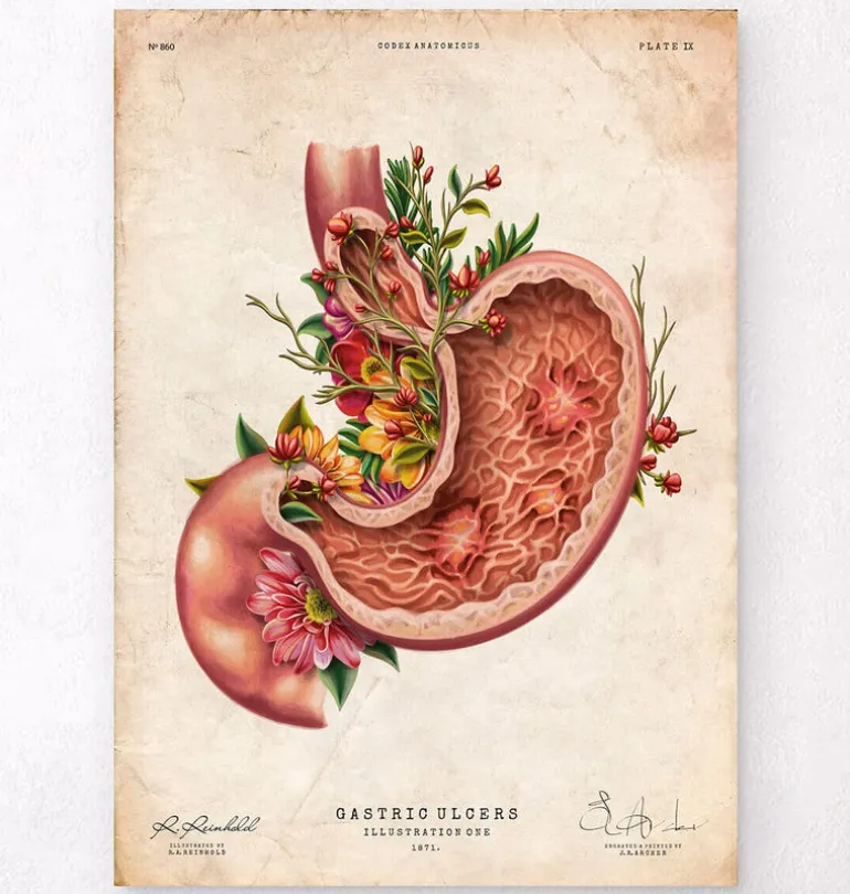 Ulcère gastrique - Floral - Vieux Papier