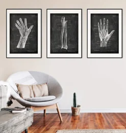 Ulna et radius - Chalkboard